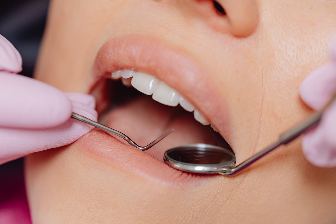 should you brush your teeth after whitening strips